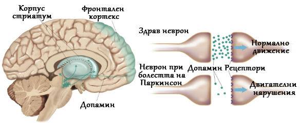 Болест на Паркинсон Неконвенционална Рехабилитация Кан Терапия